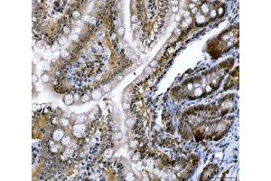 IHC analysis of CSNK2K2 using anti-CSNK2K2 antibody (ABIN7602871). (CSNK2A2 Antikörper  (C-Term))