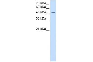 SLC16A8 antibody used at 2. (MCT3 Antikörper)