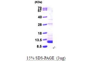 SDS-PAGE (SDS) image for S100 Calcium Binding Protein B (S100B) (AA 1-92) protein (His tag) (ABIN667030) (S100B Protein (AA 1-92) (His tag))