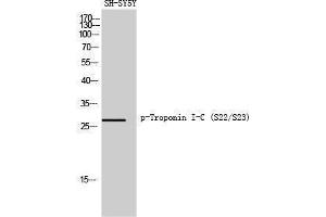 Western Blotting (WB) image for anti-Cardiac Troponin C (TNNC1) (pSer22), (pSer23) antibody (ABIN3182561) (TNNC1 Antikörper  (pSer22, pSer23))
