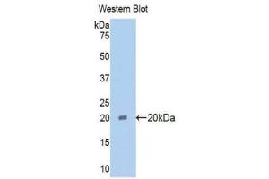 Western Blotting (WB) image for anti-Pim-1 Oncogene (PIM1) (AA 38-177) antibody (ABIN1078444)
