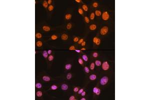 Immunofluorescence analysis of NIH-3T3 cells using PTBP1 Rabbit mAb (ABIN7269464) at dilution of 1:100 (40x lens). (PTBP1 Antikörper)