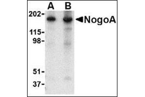 Western blot analysis of NogoA in mouse brain tissue lysate with this product at (A) 0.