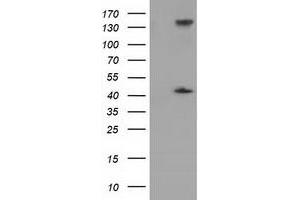 Western Blotting (WB) image for anti-phosphoribosylaminoimidazole Carboxylase, phosphoribosylaminoimidazole Succinocarboxamide Synthetase (PAICS) antibody (ABIN1500021) (PAICS Antikörper)