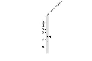 MLL2 Antikörper  (C-Term)