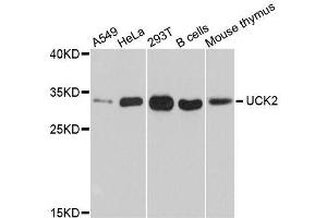 Western blot analysis of extracts of various cell lines, using UCK2 antibody. (UCK2 Antikörper  (AA 1-261))