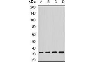Western blot analysis of SCO2 expression in HL60 (A), SKOV3 (B), mouse brain (C), rat liver (D) whole cell lysates. (SCO2 Antikörper)