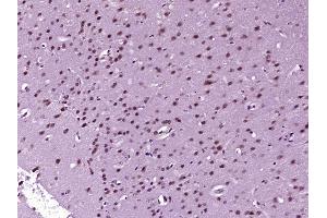 Immunohistochemistry (Paraffin-embedded Sections) (IHC (p)) image for anti-DNA Fragmentation Factor, 40kDa, beta Polypeptide (Caspase-Activated DNase) (DFFB) (AA 251-338) antibody (ABIN872776)