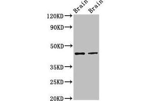Western Blot Positive WB detected in: Rat brain tissue, Mouse brain tissue All lanes: MAPK3 antibody at 3 μg/mL Secondary Goat polyclonal to rabbit IgG at 1/50000 dilution Predicted band size: 44, 39, 41 kDa Observed band size: 44 kDa (ERK1 Antikörper  (AA 11-379))