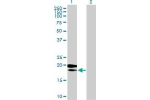 Western Blot analysis of MRPL18 expression in transfected 293T cell line by MRPL18 MaxPab polyclonal antibody. (MRPL18 Antikörper  (AA 1-180))