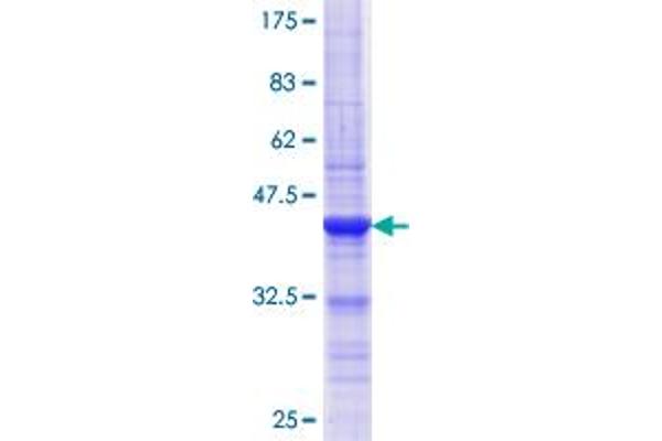 ASH2L Protein (AA 424-530) (GST tag)