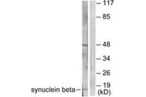 Western blot analysis of extracts from HeLa cells, using Synuclein beta Antibody.