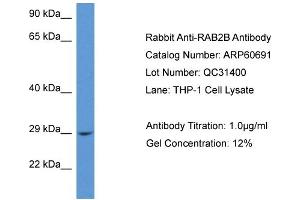Western Blotting (WB) image for anti-RAB2B, Member RAS Oncogene Family (RAB2B) (C-Term) antibody (ABIN2788539)
