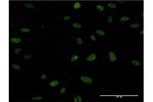 Immunofluorescence of monoclonal antibody to NUCKS1 on HeLa cell. (NUCKS1 Antikörper  (AA 1-243))