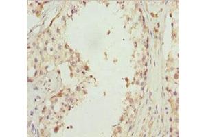 Immunohistochemistry of paraffin-embedded human testis tissue using ABIN7151422 at dilution of 1:100 (EFHC1 Antikörper  (AA 391-640))