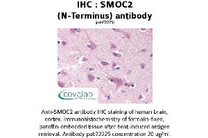 Image no. 1 for anti-SPARC Related Modular Calcium Binding 2 (SMOC2) antibody (ABIN1739464) (SMOC2 Antikörper)