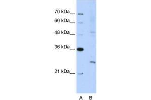 Western Blotting (WB) image for anti-Exosome Component 4 (EXOSC4) antibody (ABIN2462286) (EXOSC4 Antikörper)