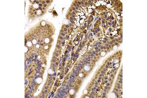 Immunohistochemistry of paraffin-embedded mouse ileum using CLASP1 antibody at dilution of 1:100 (x400 lens).