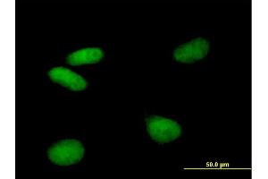 Immunofluorescence (IF) image for anti-Vacuolar Protein Sorting 72 Homolog (S. Cerevisiae) (VPS72) (AA 1-364) antibody (ABIN948532)