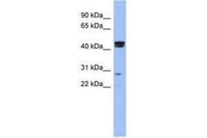 Image no. 1 for anti-Heat Shock Transcription Factor, Y-Linked 1 (HSFY1) (N-Term) antibody (ABIN6742900) (HSFY1 Antikörper  (N-Term))