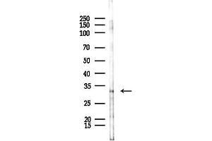anti-Ring Finger Protein 144B (RNF144B) (Internal Region) antibody