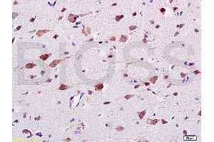 Formalin-fixed and paraffin embedded: rat brain tissue labeled with Anti-CaMK2b Polyclonal Antibody (ABIN669876), Unconjugated at 1:200 followed by conjugation to the secondary antibody and DAB staining (CAMK2B Antikörper  (AA 1-100))