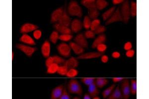 Immunofluorescence analysis of HeLa cells using PIDD Polyclonal Antibody at dilution of 1:100 (40x lens). (PIDD Antikörper)