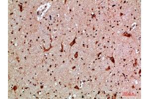 Immunohistochemical analysis of paraffin-embedded human-brain, antibody was diluted at 1:200 (MBL2 Antikörper  (AA 21-70))