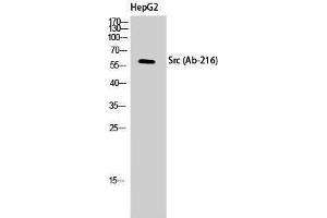 Western Blotting (WB) image for anti-Proto-oncogene tyrosine-protein kinase Src (Src) (Tyr1161) antibody (ABIN3174585) (Src Antikörper  (Tyr1161))