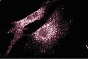 Immunofluorescence staining of NIH/3T3 cells (Mouse embryo fibroblast cells, ATCC CRL-1658). (SLC9A1 Antikörper  (AA 682-801))