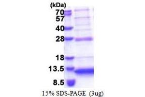 Chromosome 5 Open Reading Frame 13 (C5orf13) (AA 1-68) protein (His tag)