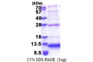 SDS-PAGE (SDS) image for Chromosome 5 Open Reading Frame 13 (C5orf13) (AA 1-68) protein (His tag) (ABIN6387336)