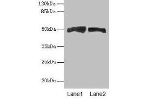 Western blot All lanes: AZIN1 antibody at 4 μg/mL Lane 1: Mouse liver tissue Lane 2: PC-3 whole cell lysate Secondary Goat polyclonal to rabbit IgG at 1/10000 dilution Predicted band size: 50 kDa Observed band size: 50 kDa (Antizyme Inhibitor 1 Antikörper  (AA 101-400))