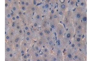 Immunohistochemistry (IHC) image for anti-C-Ros Oncogene 1 , Receptor tyrosine Kinase (ROS1) (AA 1945-2222) antibody (ABIN7442438)