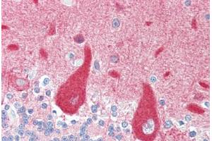 Human Brain, Cerebellum (formalin-fixed, paraffin-embedded) stained with CRMP1 antibody ABIN461920 at 5 ug/ml followed by biotinylated goat anti-rabbit IgG secondary antibody ABIN481713, alkaline phosphatase-streptavidin and chromogen. (CRMP1 Antikörper  (N-Term))