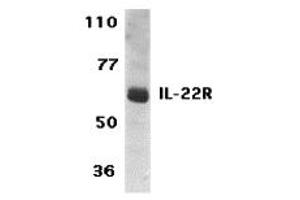 Western Blotting (WB) image for anti-Interleukin 22 Receptor (IL22R) (C-Term) antibody (ABIN1030435) (IL22R Antikörper  (C-Term))