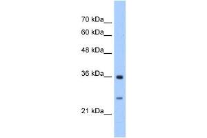GSTZ1 antibody used at 2. (GSTZ1 Antikörper)