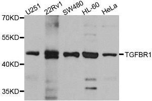 Western blot analysis of extracts of various cell lines, using TGFBR1 antibody. (TGFBR1 Antikörper  (AA 34-124))