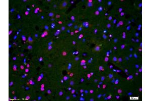Formalin-fixed and paraffin-embedded rat brain labeled with Anti-Phospho-HER3(Tyr1328) Polyclonal Antibody, Unconjugated (ABIN800628) 1:200, overnight at 4°C, The secondary antibody was Goat Anti-Rabbit IgG, Cy3 conjugated used at 1:200 dilution for 40 minutes at 37°C. (ERBB3 Antikörper  (pTyr1328))