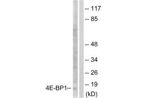 Western Blotting (WB) image for anti-Eukaryotic Translation Initiation Factor 4E Binding Protein 1 (EIF4EBP1) (Ser65) antibody (ABIN1847928) (eIF4EBP1 Antikörper  (Ser65))