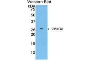 Western Blotting (WB) image for anti-Tubulin Polymerization Promoting Protein (Tppp) (AA 8-210) antibody (ABIN1860848) (Tppp Antikörper  (AA 8-210))