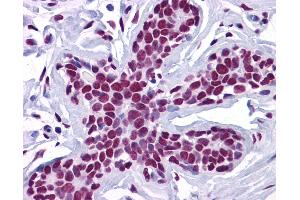 Anti-ZSCAN4 antibody IHC of human breast. (ZSCAN4 Antikörper  (C-Term))