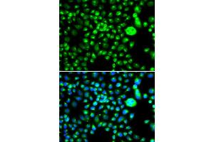 Immunofluorescence analysis of MCF-7 cells using SMCHD1 antibody (ABIN5974343).