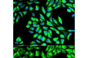 Immunofluorescence analysis of HeLa cells using EEF1A1 Polyclonal Antibody (eEF1A1 Antikörper)