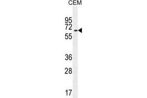 UNCX Antibody (C-term) western blot analysis in CEM cell line lysates (35 µg/lane). (UNCX Antikörper  (C-Term))