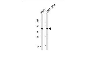 Western Blot at 1:1000 dilution Lane 1: K562 whole cell lysate Lane 2: CCRF-CEM whole cell lysate Lysates/proteins at 20 ug per lane.