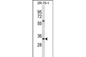 ING2 Antibody (Center) (ABIN1881460 and ABIN2838392) western blot analysis in ZR-75-1 cell line lysates (35 μg/lane). (ING2 Antikörper  (AA 112-141))