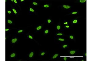 Immunofluorescence (IF) image for anti-Hepatoma-Derived Growth Factor-Related Protein 3 (HDGFRP3) (AA 1-203) antibody (ABIN526341)