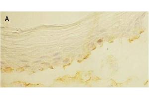 Immunohistochemistry image of Laminin 5 staining in cryosection of bullous pemphigoid Skin. (Laminin 5 Antikörper)