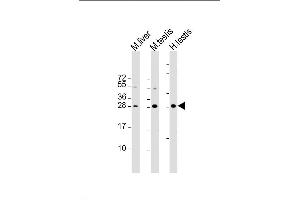 Lane 1: mouse liver lysates, Lane 2: mouse testis lysates, Lane 3: human testis lysates, probed with CDX1 (937CT11. (CDX1 Antikörper)